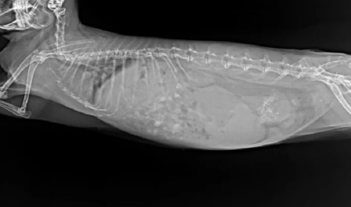 аденокарцинома матки